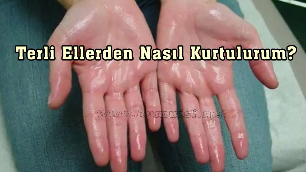 Terli Ellerden Nasıl Kurtulurum