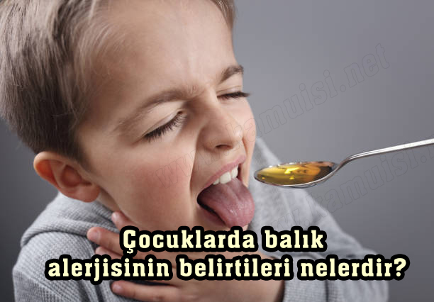 Çocuklarda balık alerjisinin belirtileri nelerdir?