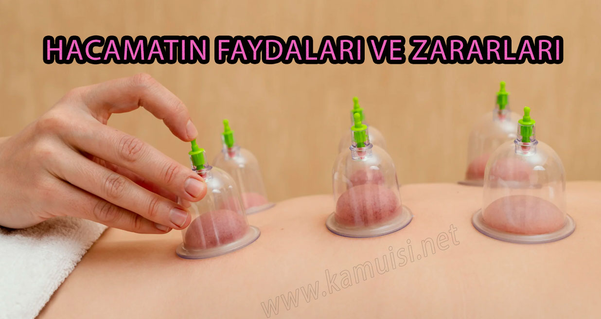 HACAMATIN FAYDALARI VE ZARARLARI